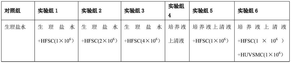 Hair follicle microarray co-culture system and application in medicine for treating pathological alopecia