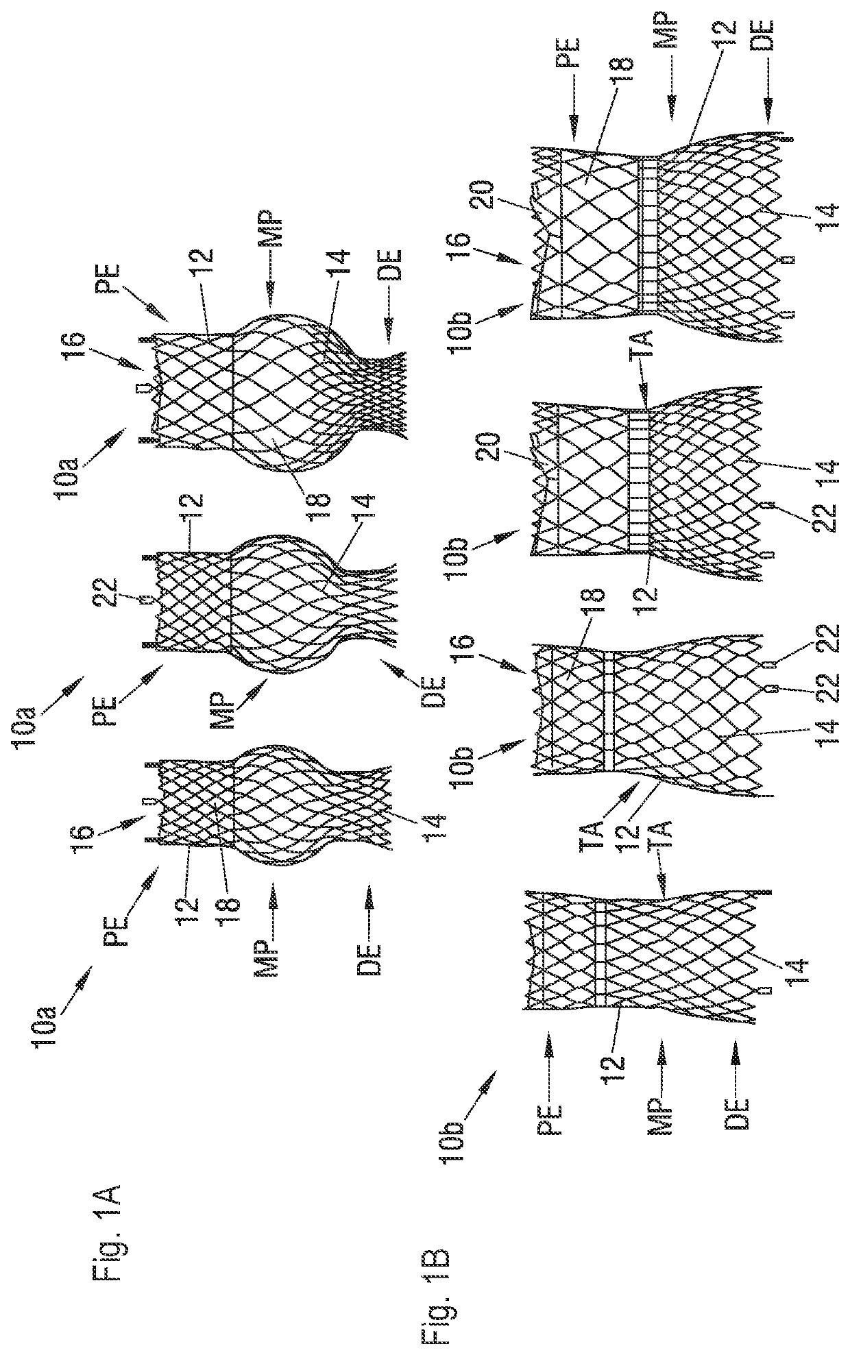 Self-expandable stent and set of stents
