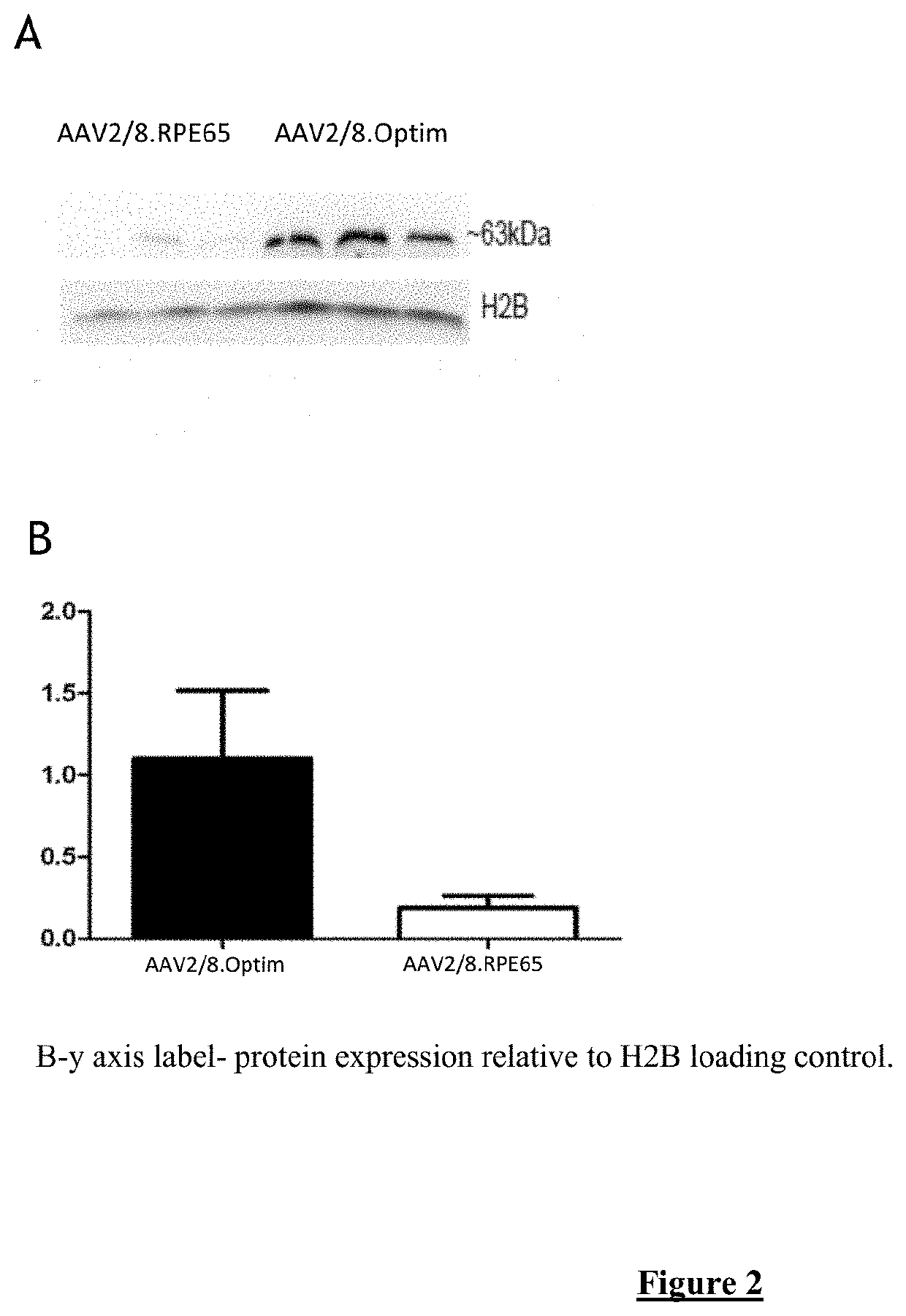 Optimized RPE65 Promoter and Coding Sequences