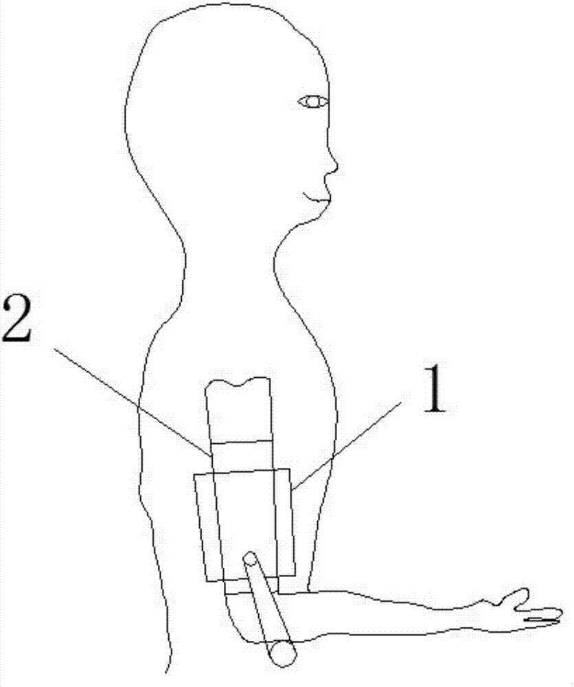 Shoulder joint subluxation shoulder protecting device