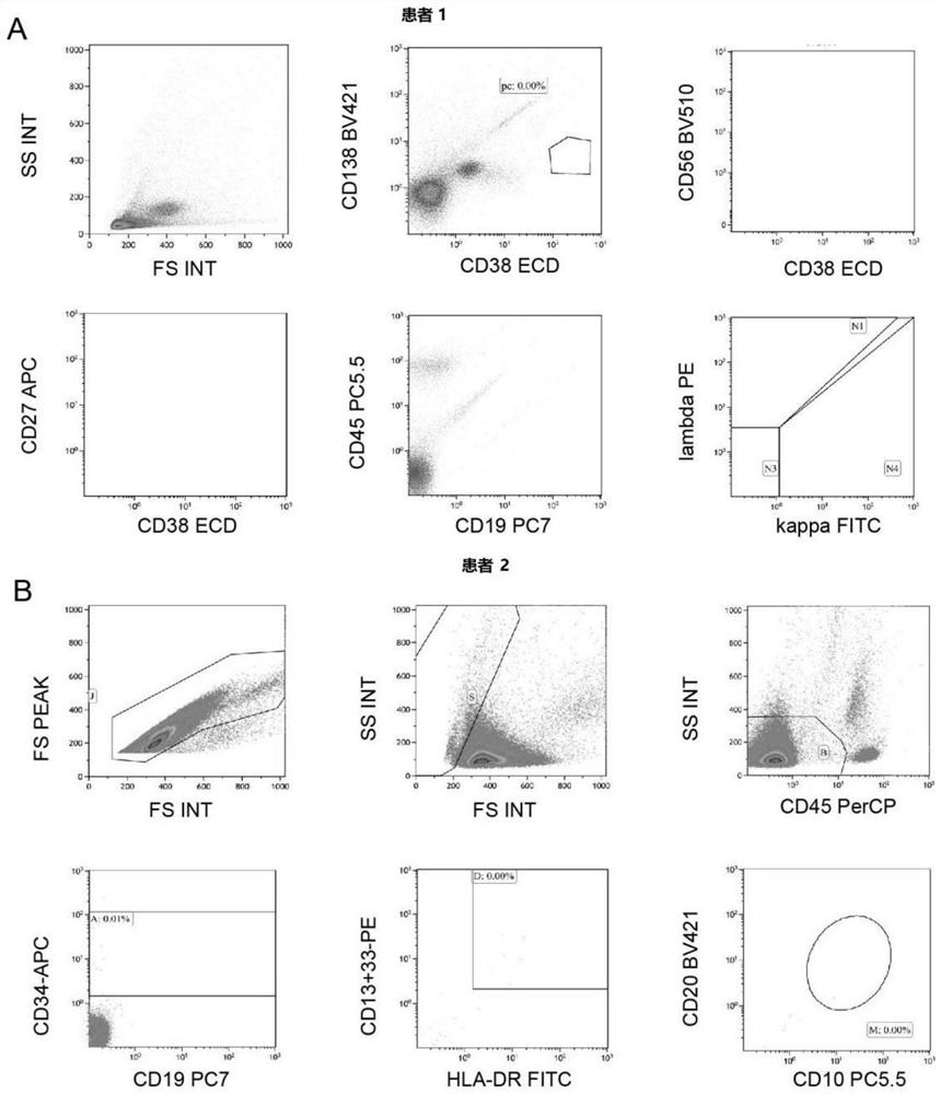 Application of tripterygium glycosides tablet in preparation of drugs for treating CAR-T induced cytokine release syndrome