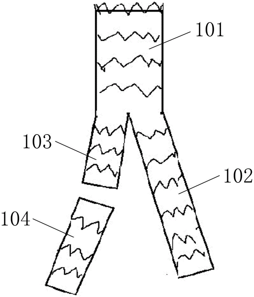 Abdominal aortic stent graft