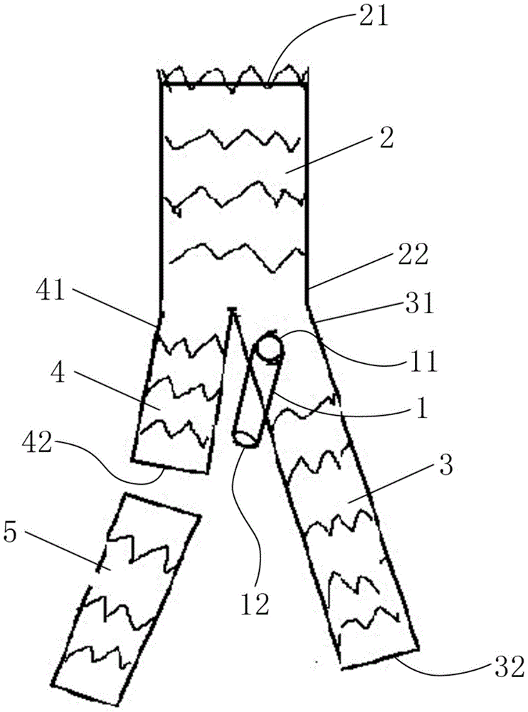 Abdominal aortic stent graft