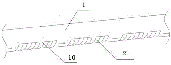 an infusion catheter