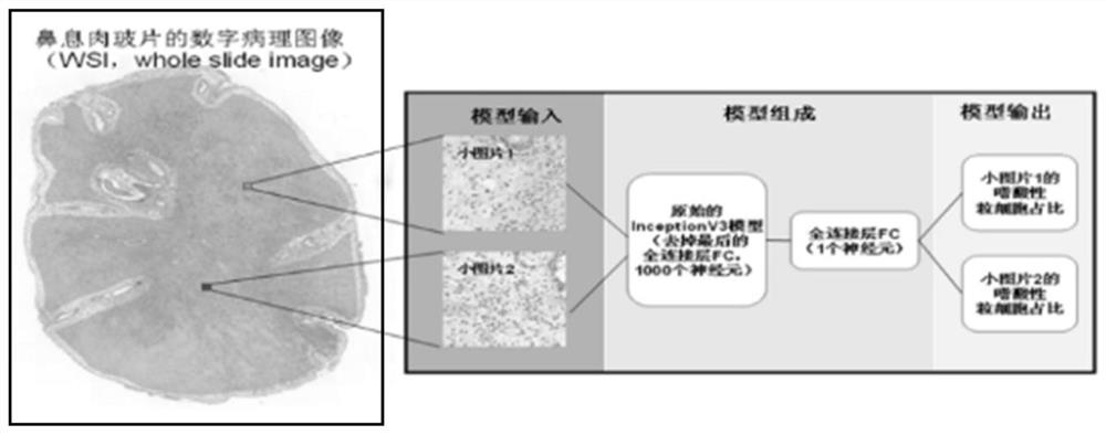 A method for establishing a model of eosinophil proportion using pathological pictures of nasal polyps