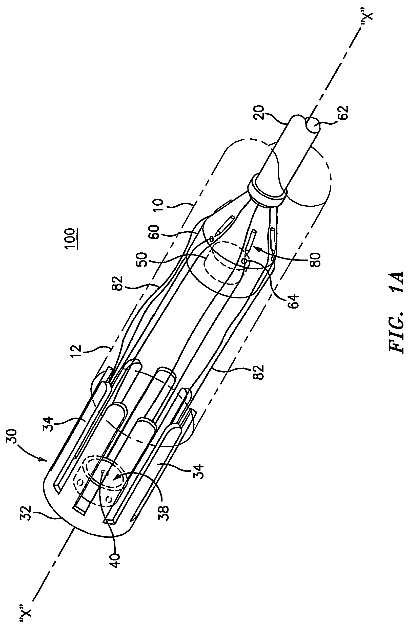 Method and apparatus for radical prostatectomy anastomosis including an anchor for engaging a body vessel and deployable sutures