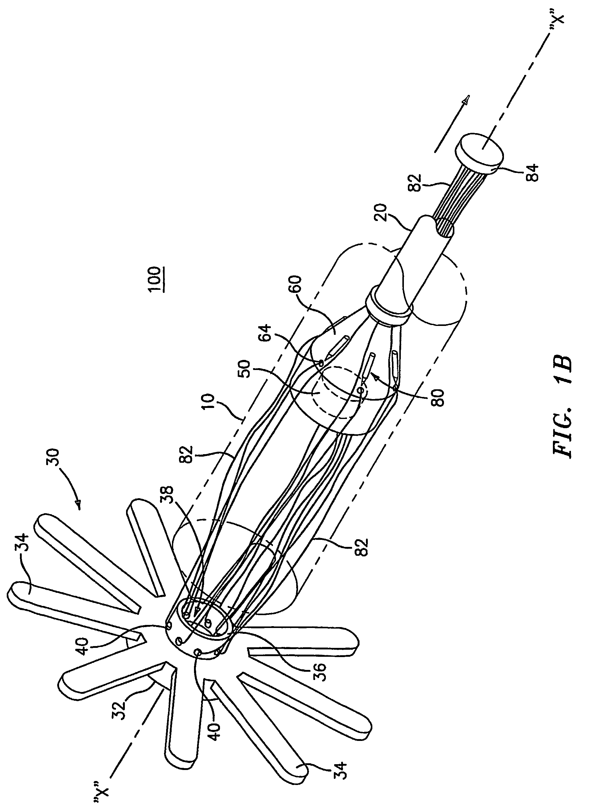 Method and apparatus for radical prostatectomy anastomosis including an anchor for engaging a body vessel and deployable sutures