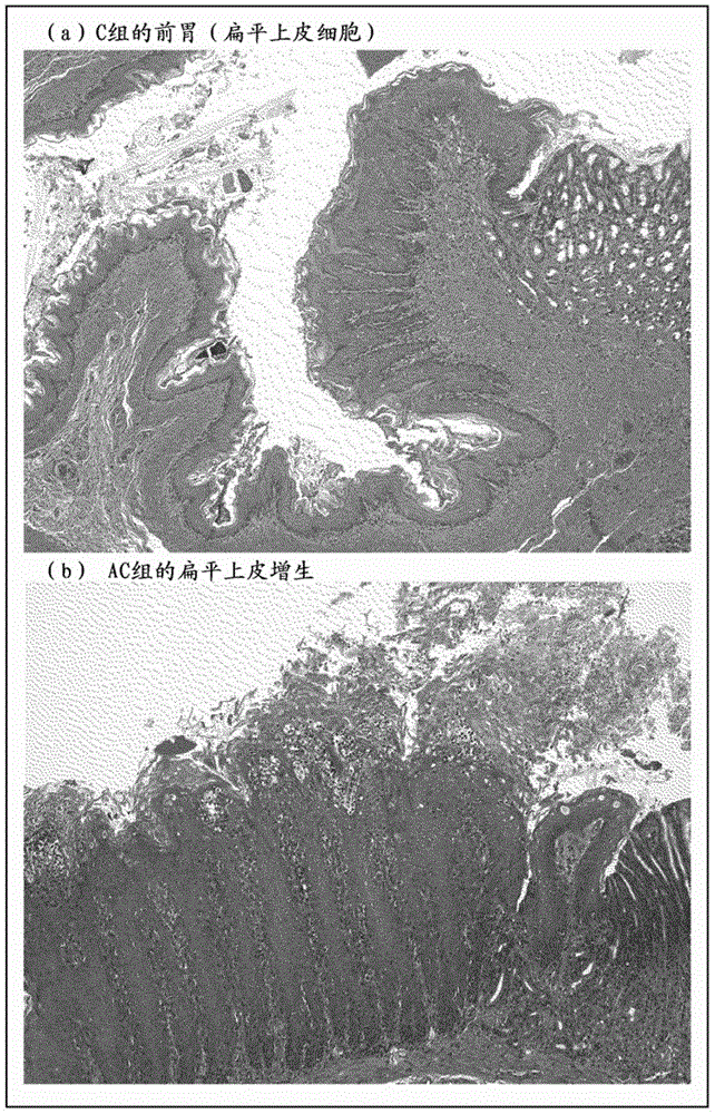 Prophylactic agent for squamous carcinoma, squamous carcinoma model anima, and method for producing said model animal