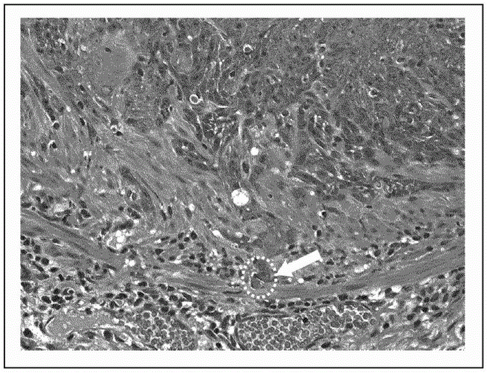 Prophylactic agent for squamous carcinoma, squamous carcinoma model anima, and method for producing said model animal