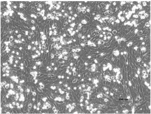 In vitro 3D liver model, enterohepatic co-culture model, building methods of the models and applications of the models