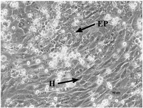 In vitro 3D liver model, enterohepatic co-culture model, building methods of the models and applications of the models