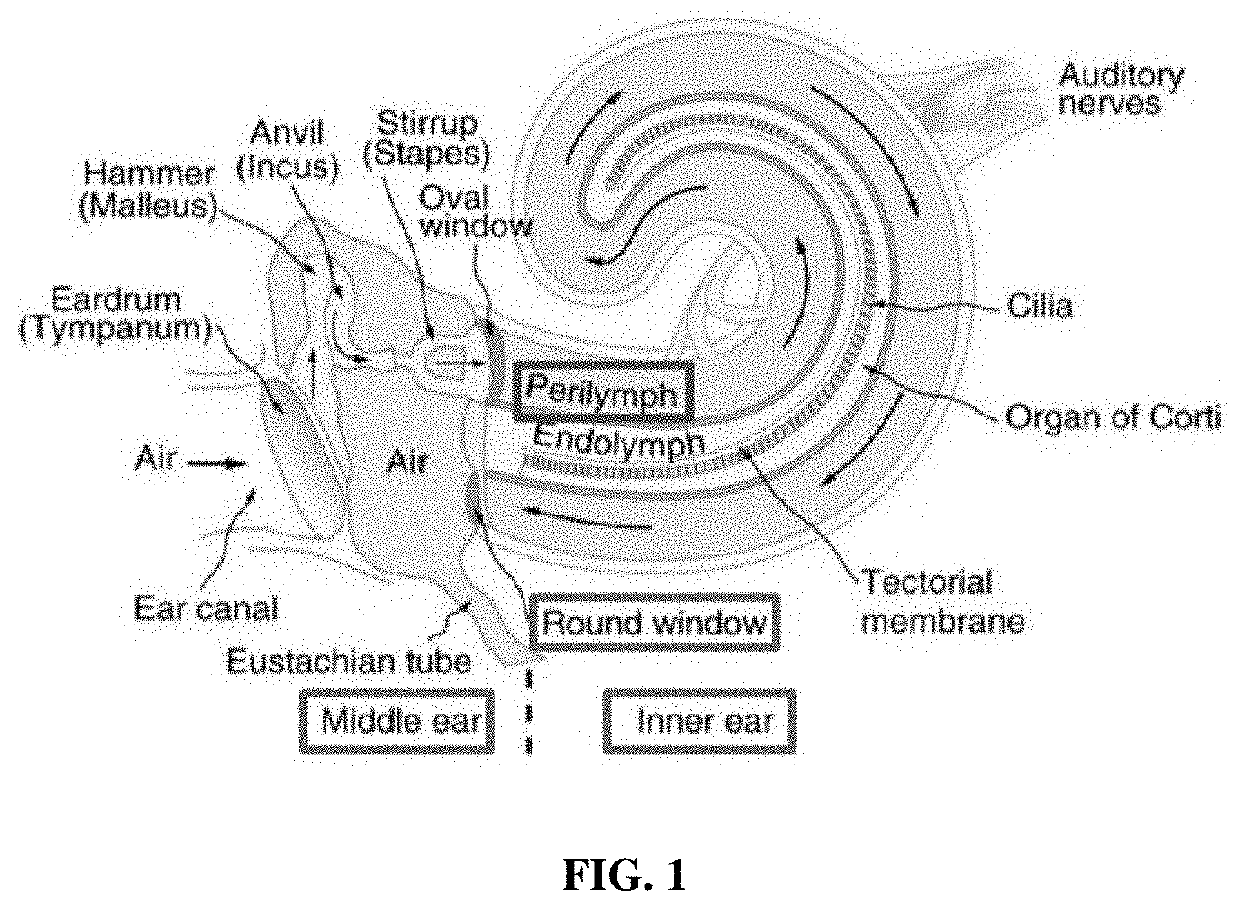 Apoptosis inhibitor formulations for prevention of hearing loss