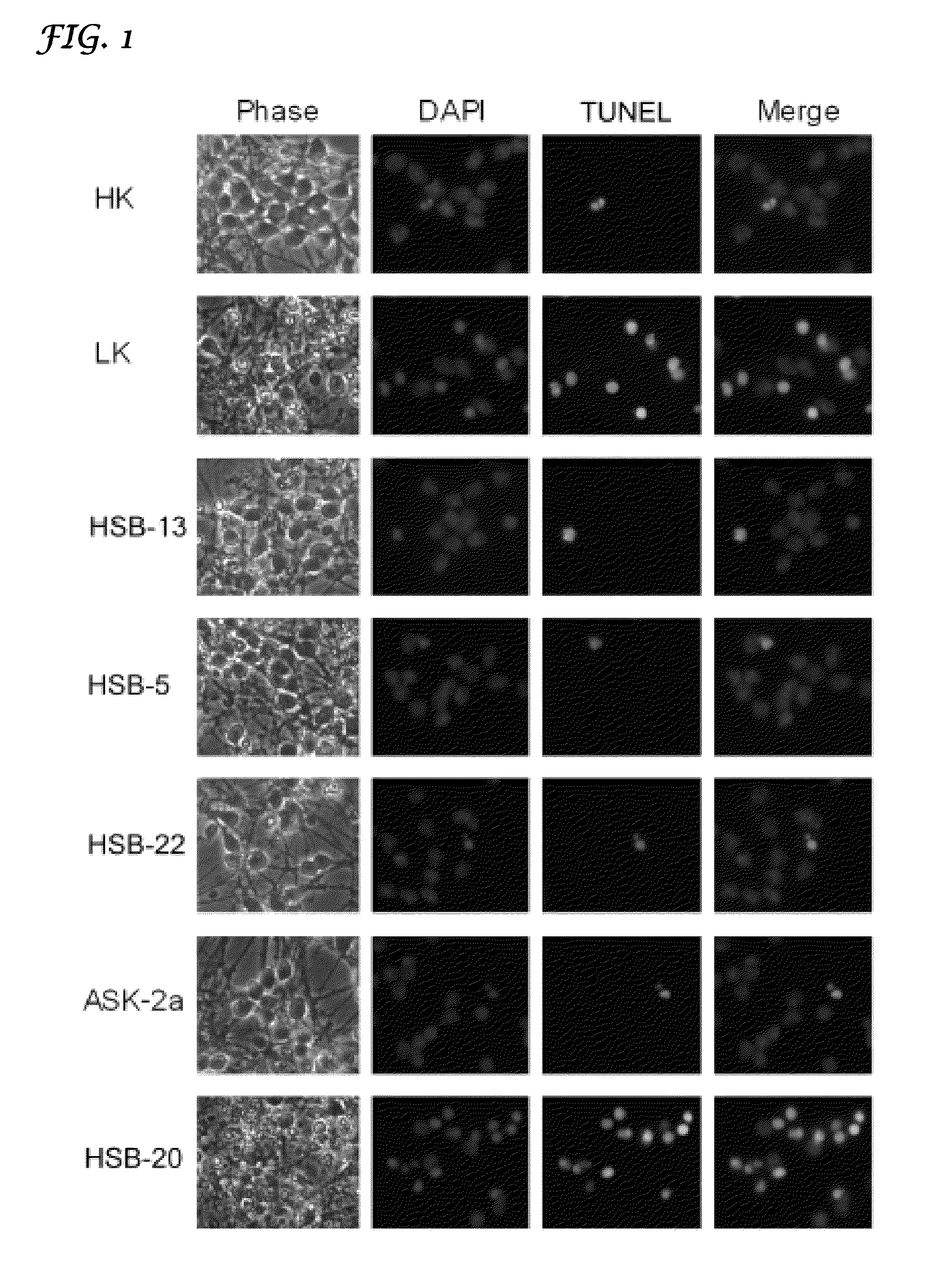 1, 4-benzoxazine compounds and derivatives thereof as therapeutic drugs for the treatment of neurodegenerative conditions