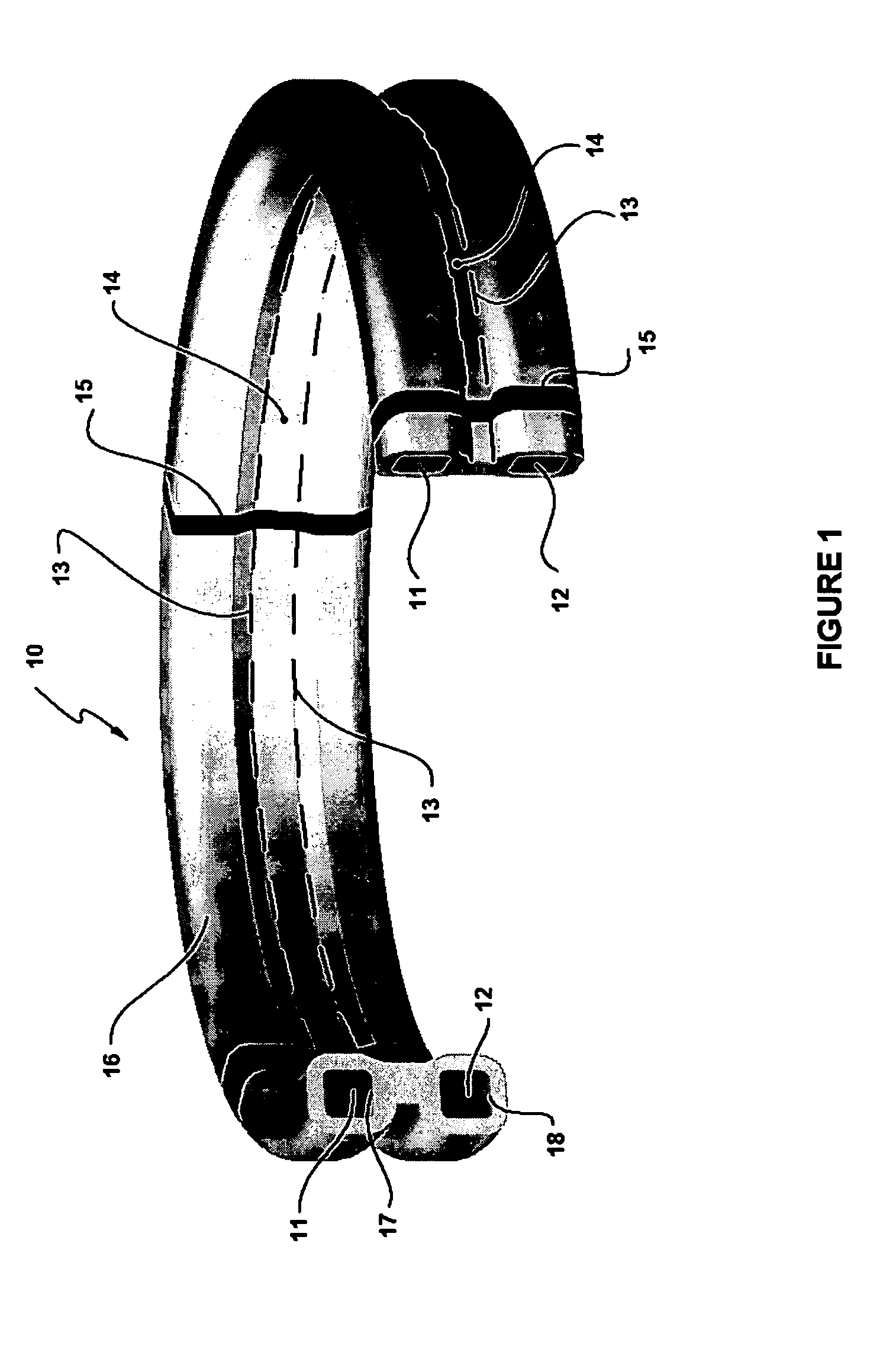 Expandable annuloplasty ring and associated ring holder