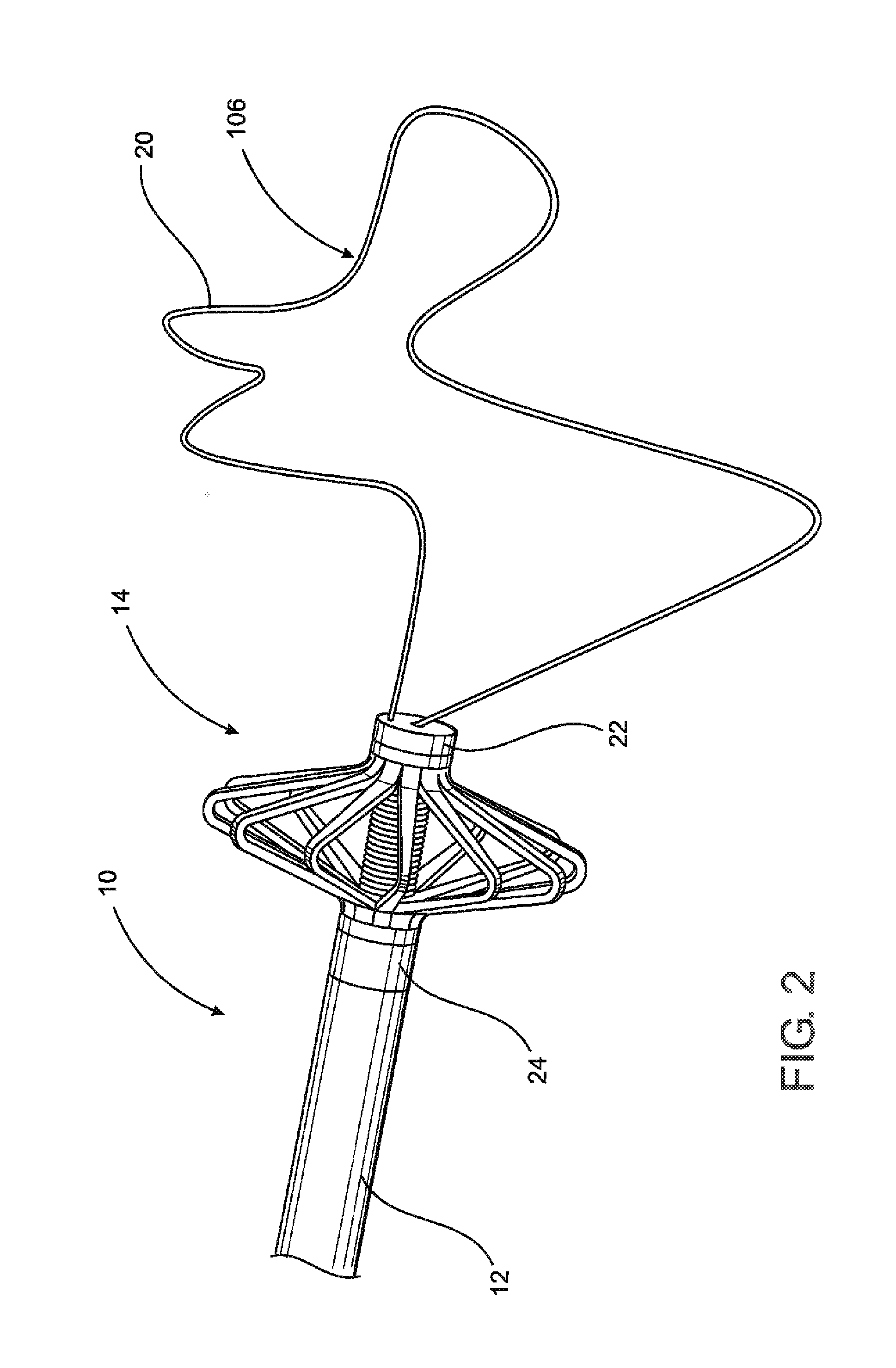 Assembly and method for left atrial appendage occlusion