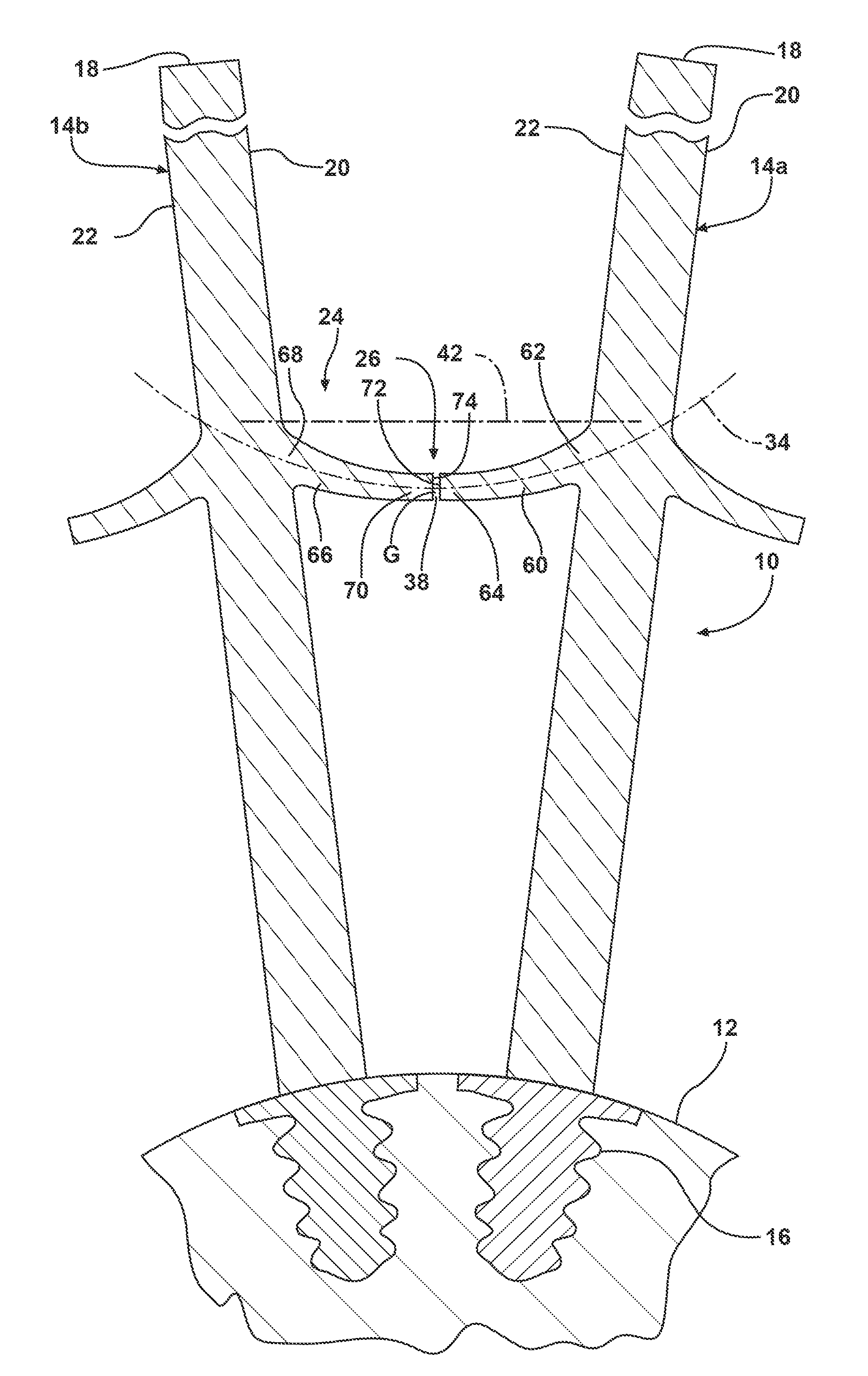 Turbine Blade Damping Device with Controlled Loading