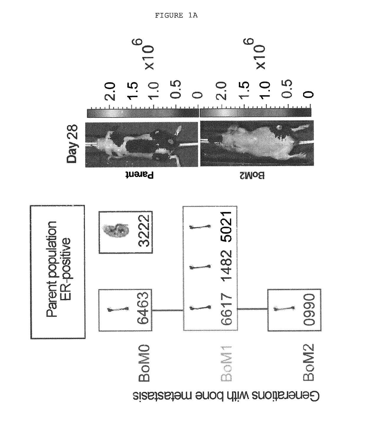 Method for the diagnosis, prognosis and treatment of breast cancer metastasis