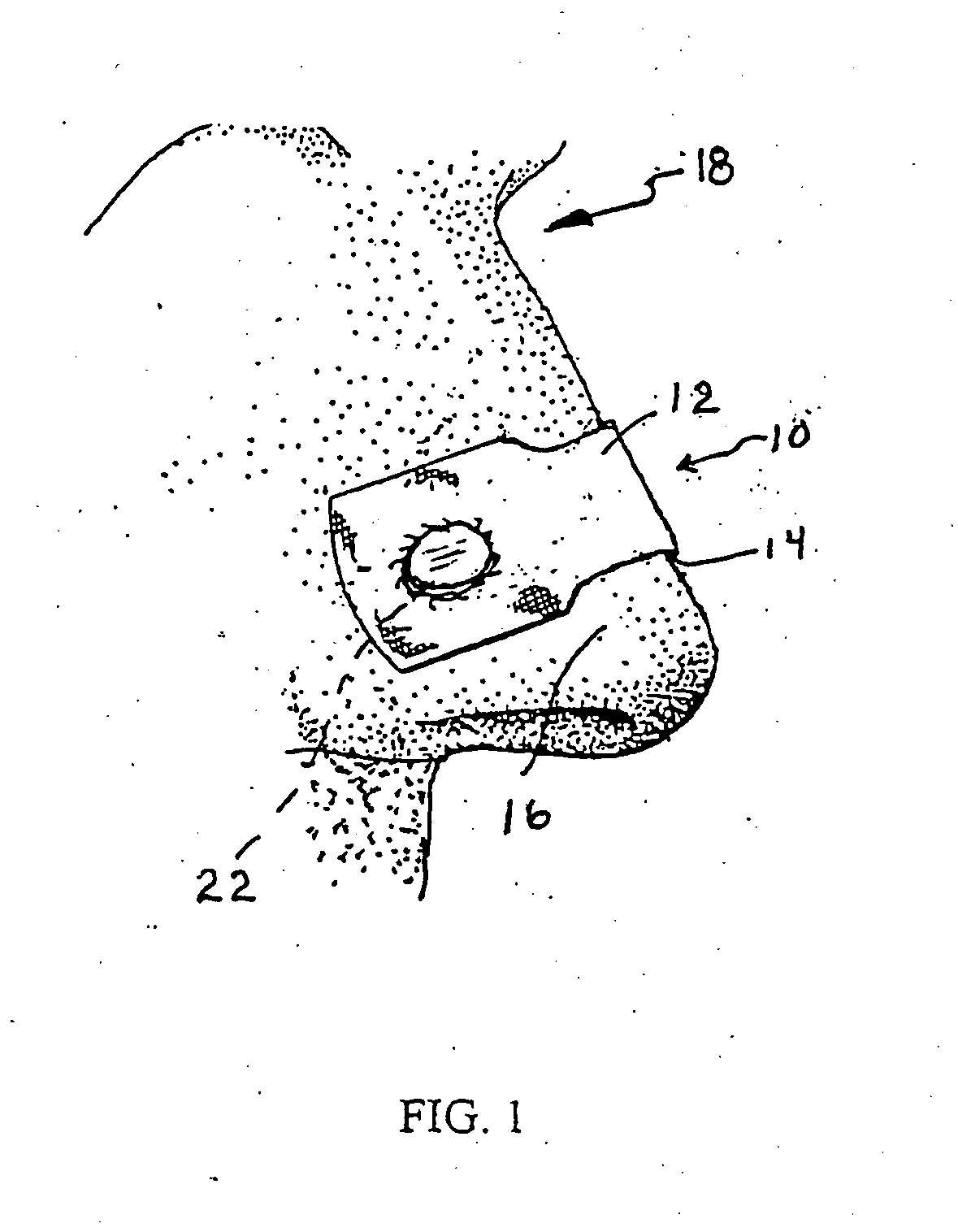 Nasal devices including dilation and user communication and methods of using same