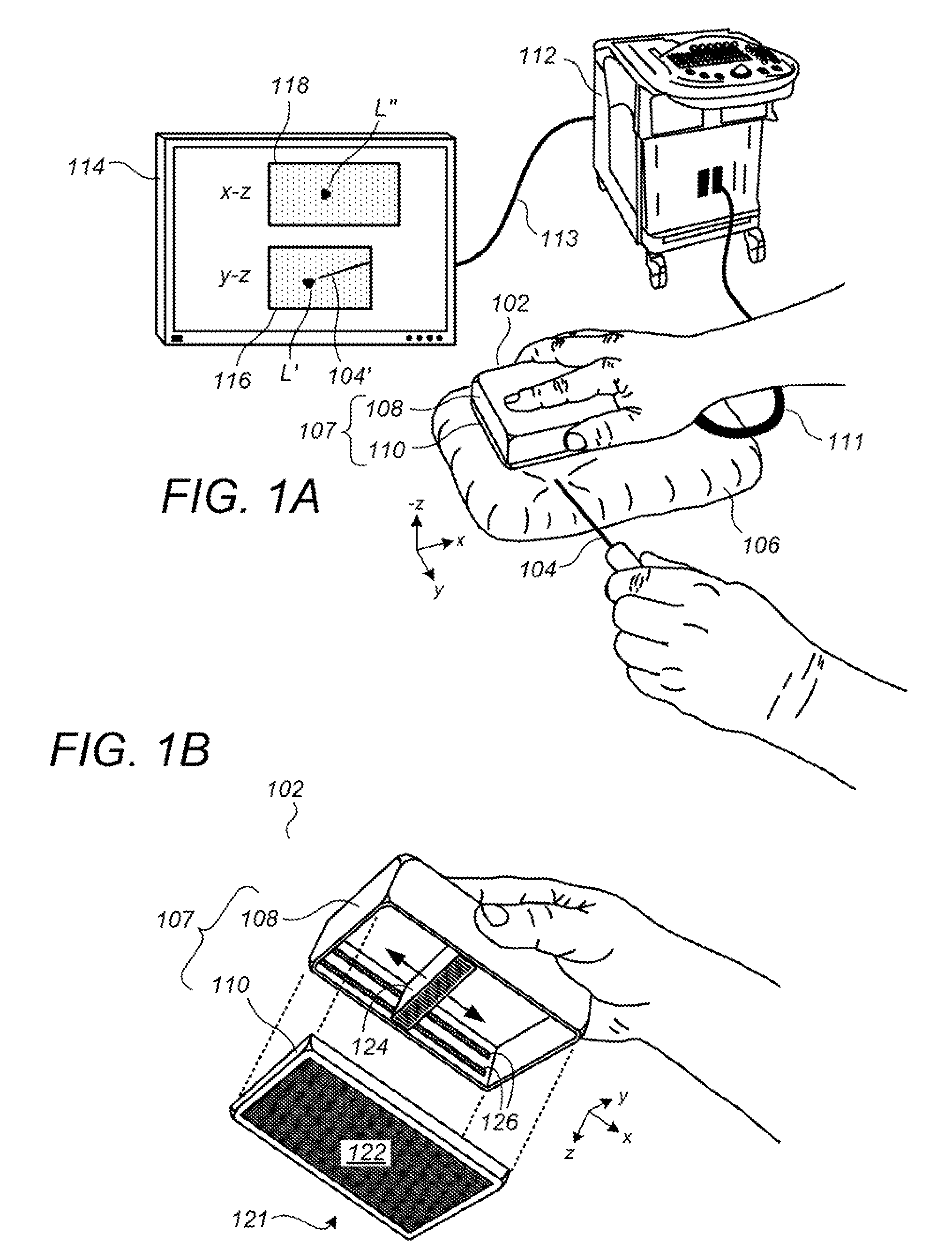 Handheld volumetric ultrasound scanning device