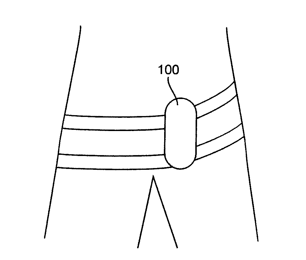 Device For Control of Difficult to Compress Hemorrhage