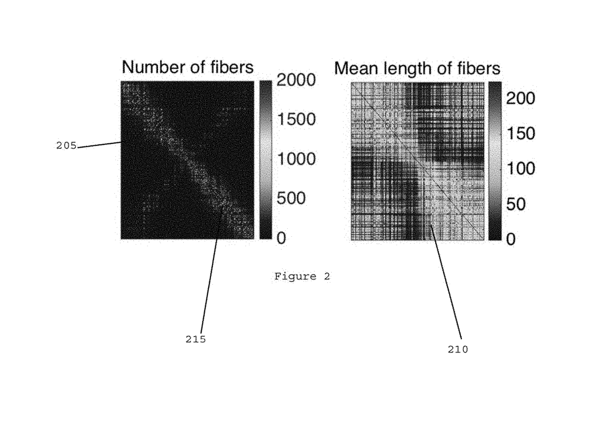 System, method and computer-accessible medium for diffusion imaging acquisition and analysis