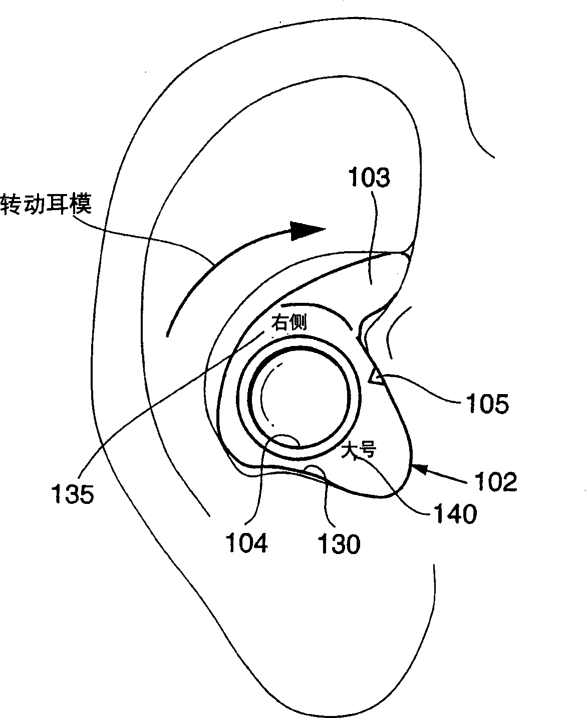 Retained ear mould for improving combination device