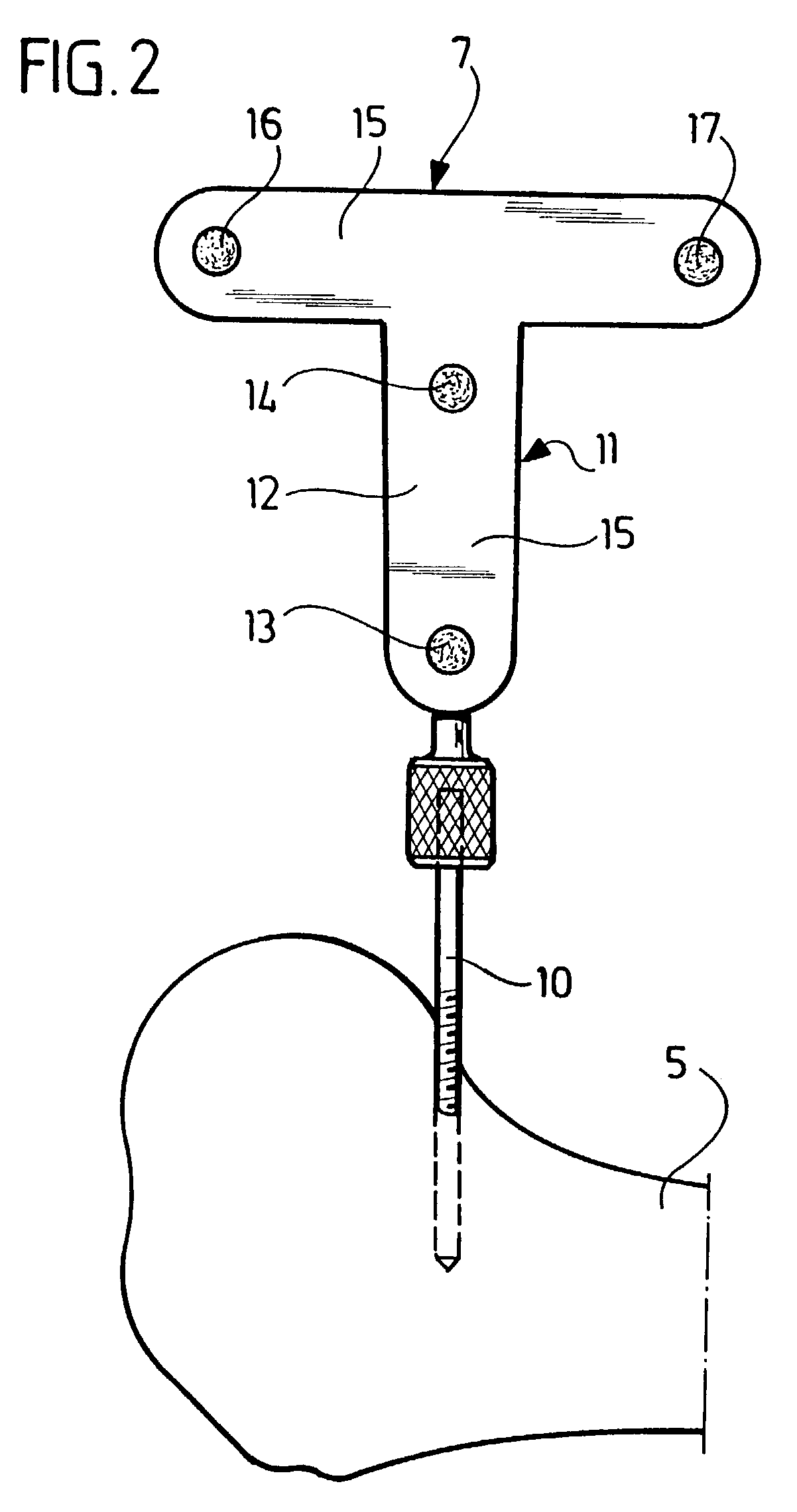 Method and device for determining the mechanical axis of a femur