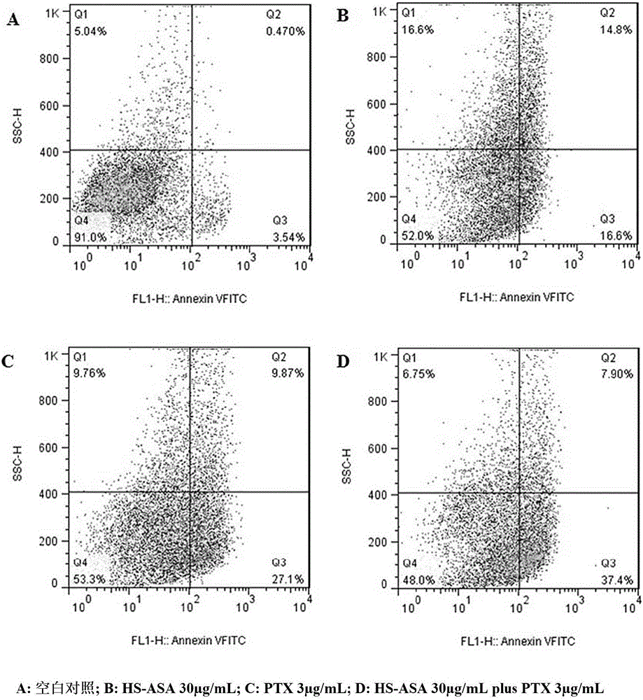 Anticancer pharmaceutical composition, preparation thereof and preparing method