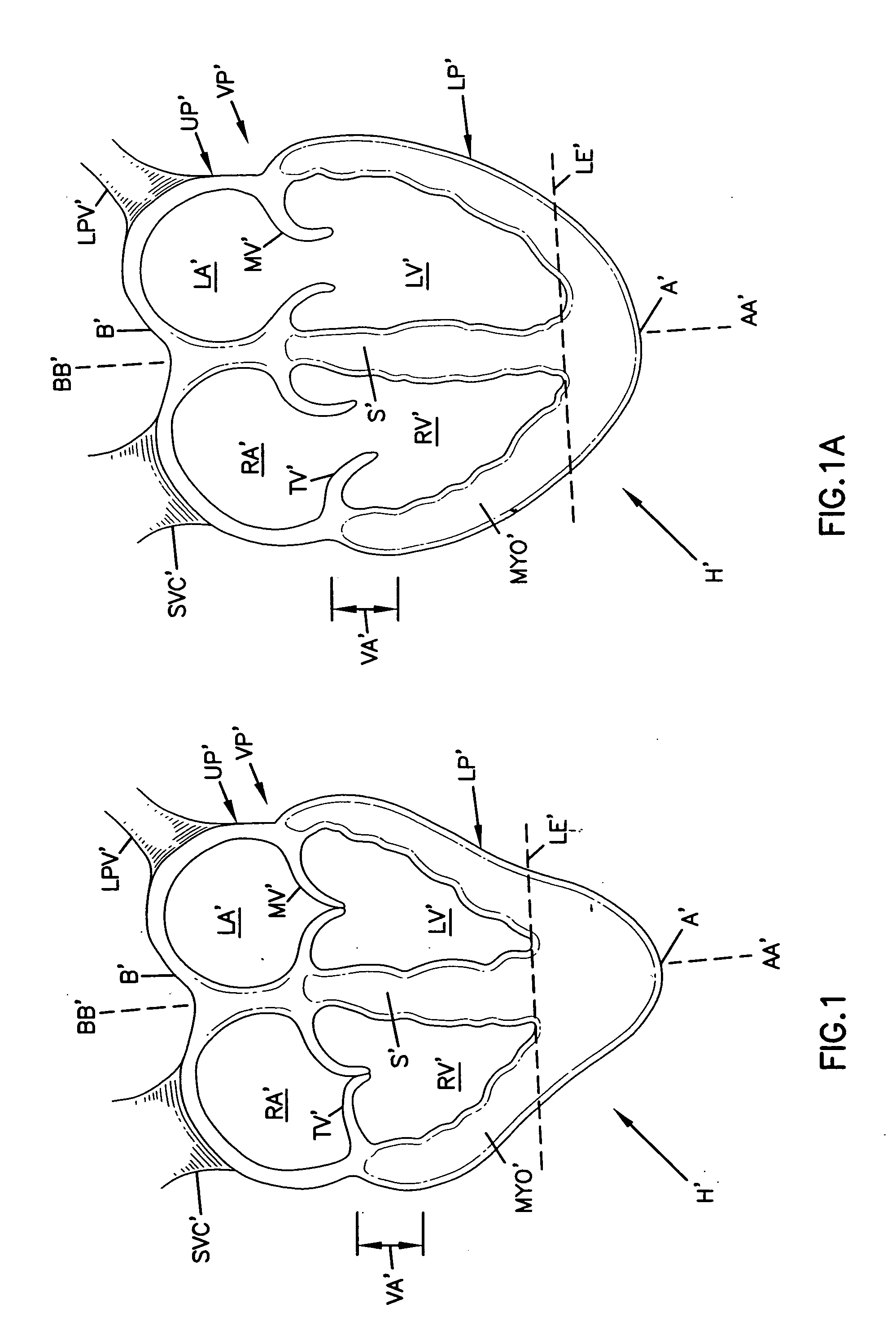 Cardiac support device