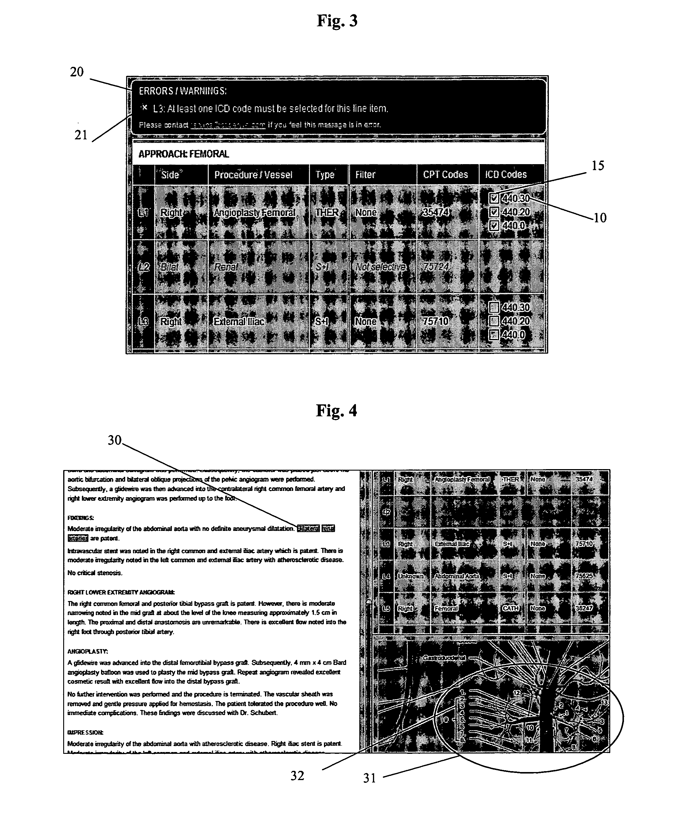System and method for medical coding of vascular interventional radiology procedures