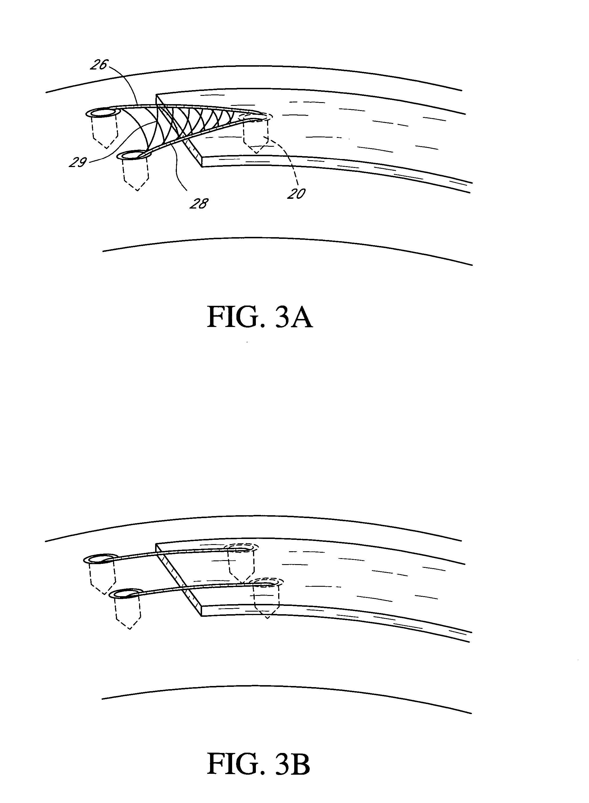System and method for attaching soft tissue to bone