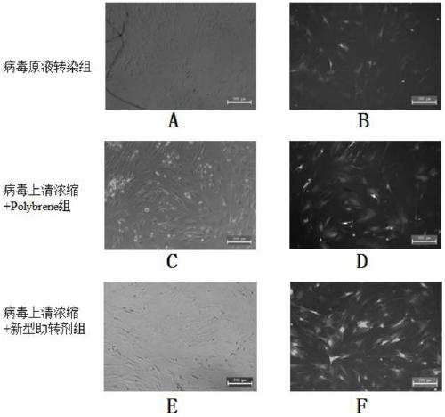 Method for transfection of bone mesenchymal stem cells by BDNF