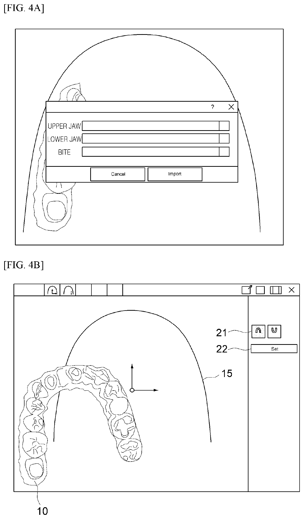 Prosthesis design method and system based on arch line