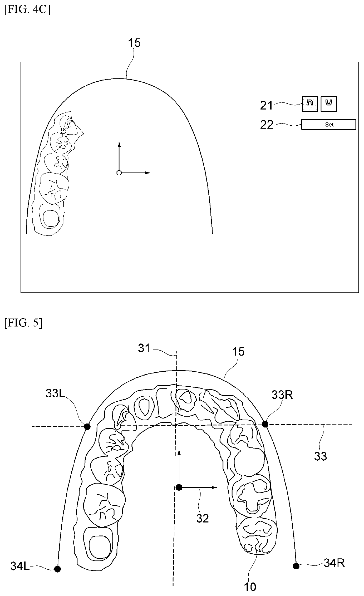 Prosthesis design method and system based on arch line