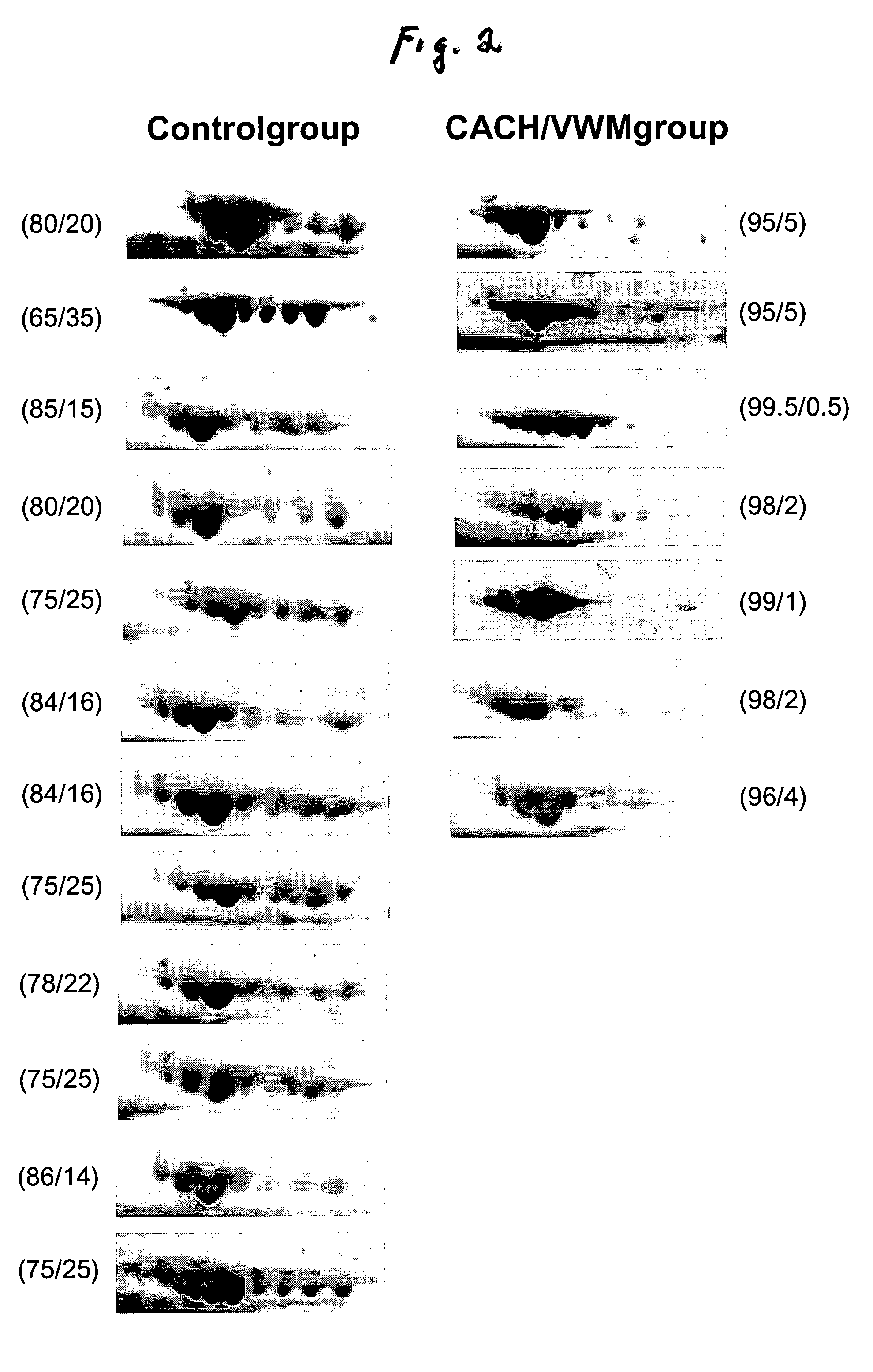 Biochemical marker for diagnosing a leukodystrophy