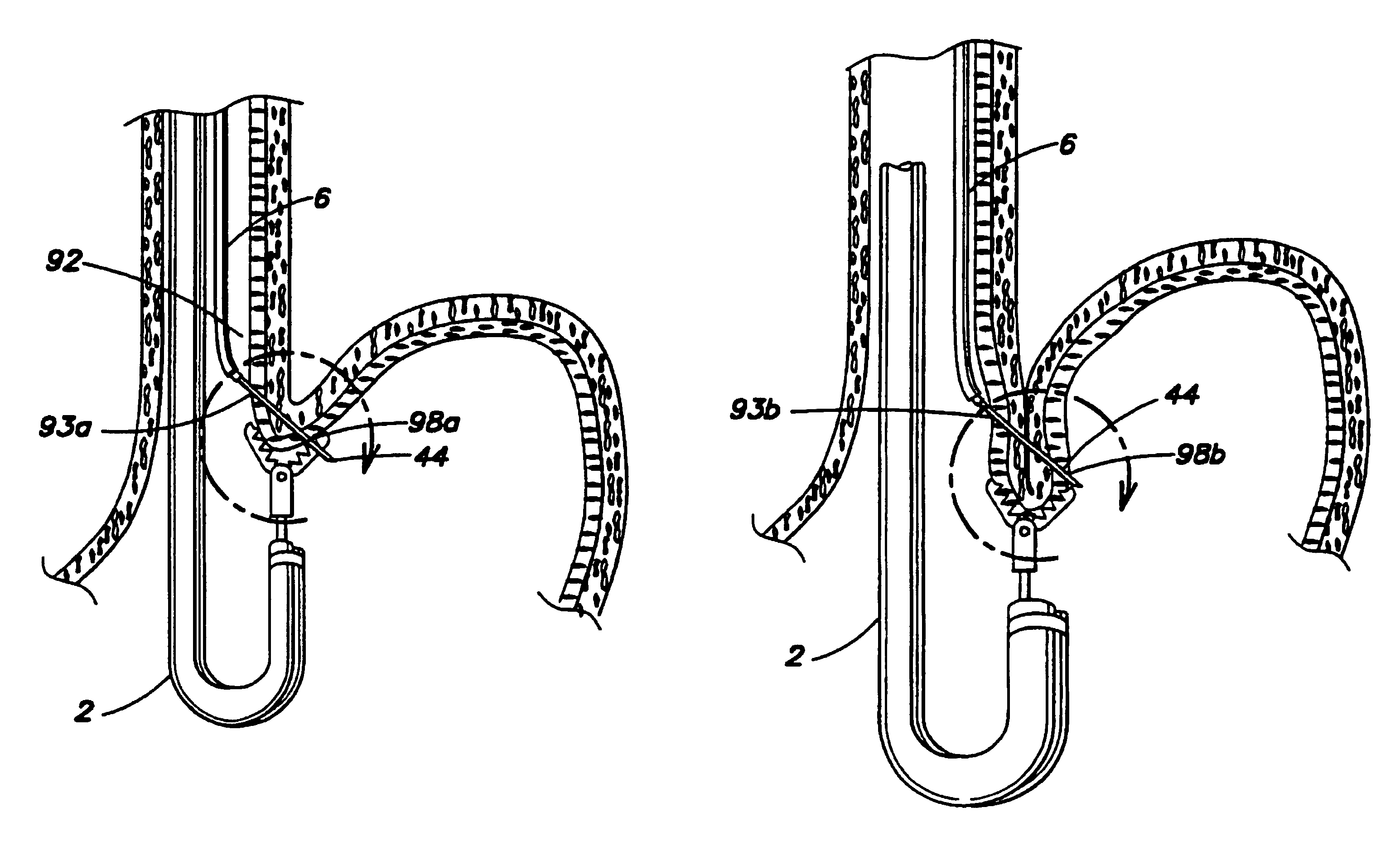 Endoscopic method for forming an artificial valve