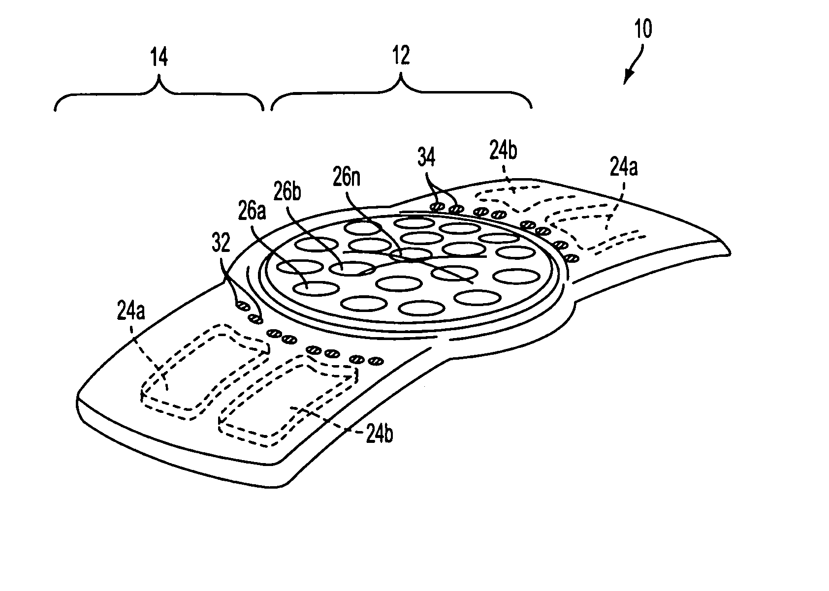 Lens system and method for power adjustment using externally actuated micropumps