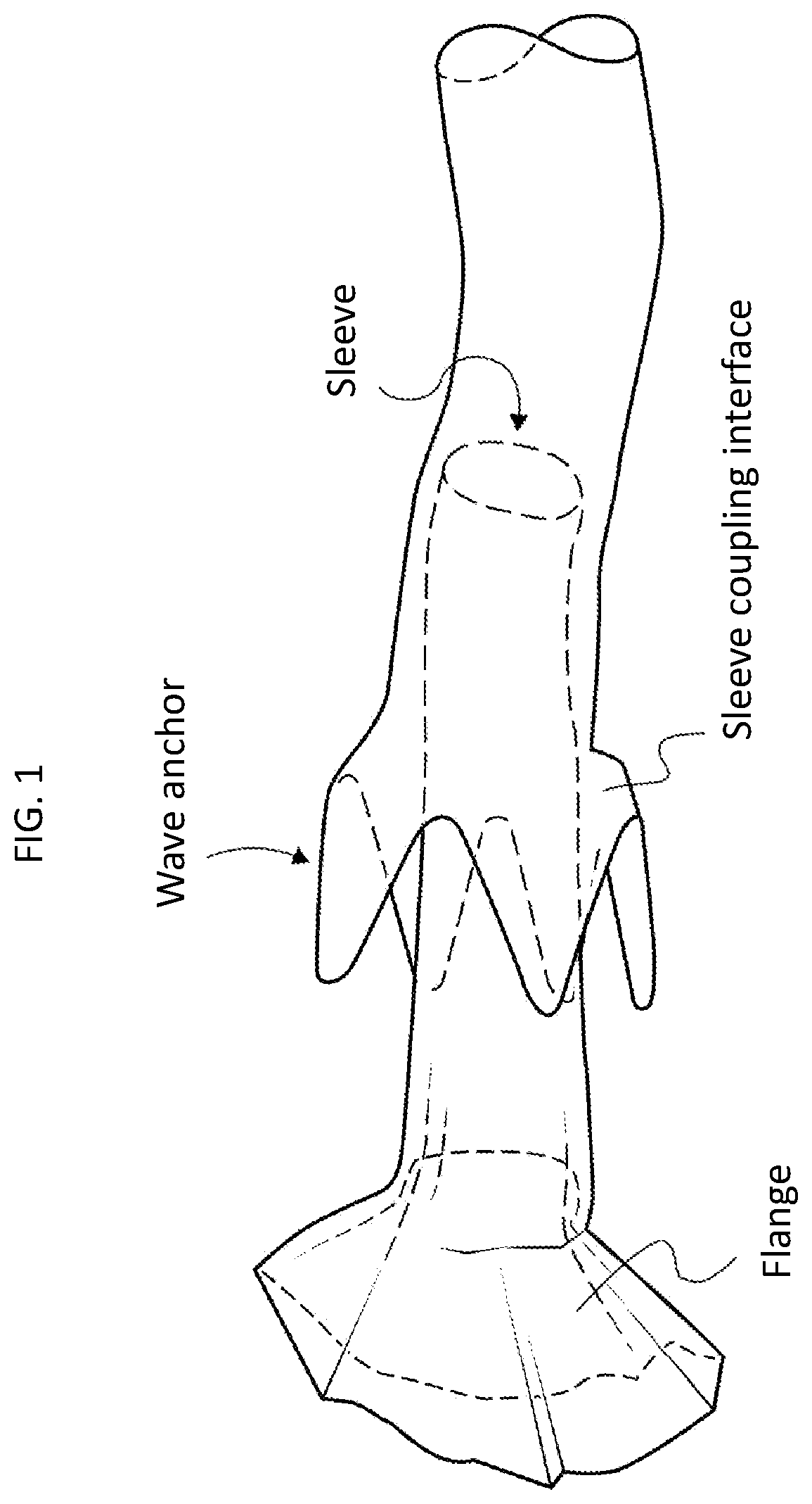 Flanged gastrointestinal devices and methods of use thereof