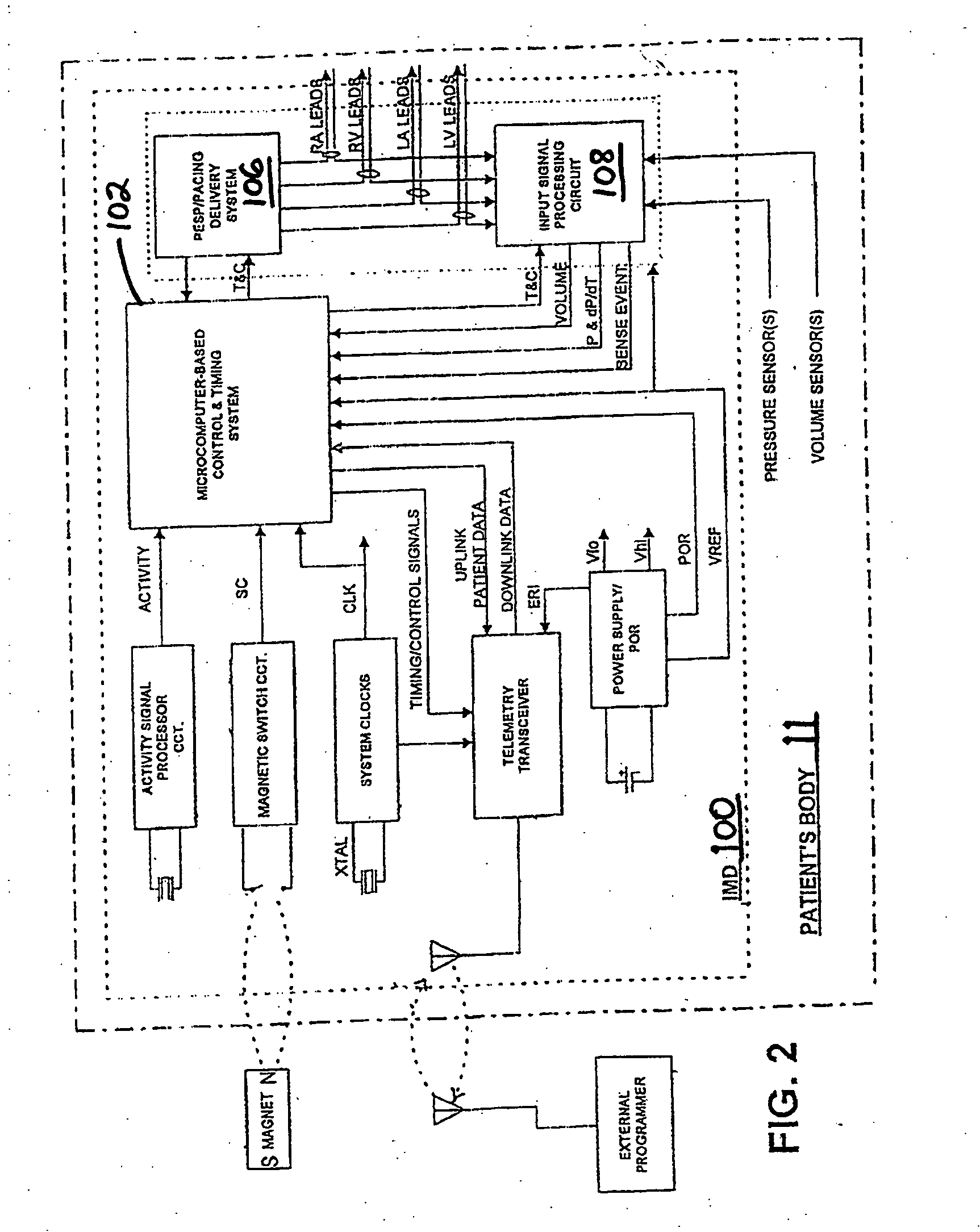 Method and system for controlling pulmonary capillary pressure