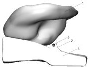 Flexible high-elasticity auricular cartilage scaffold capable of accurately reproducing cranium-ear angle