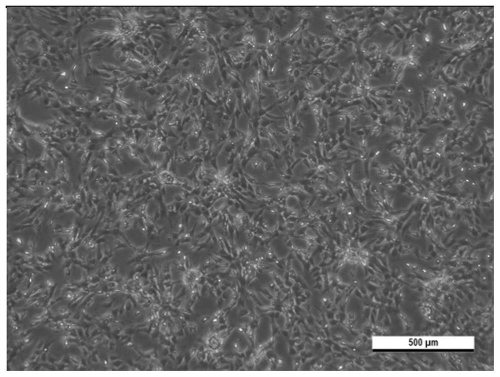 Preparation method and application of parietal decidua subtotipotent stem cells