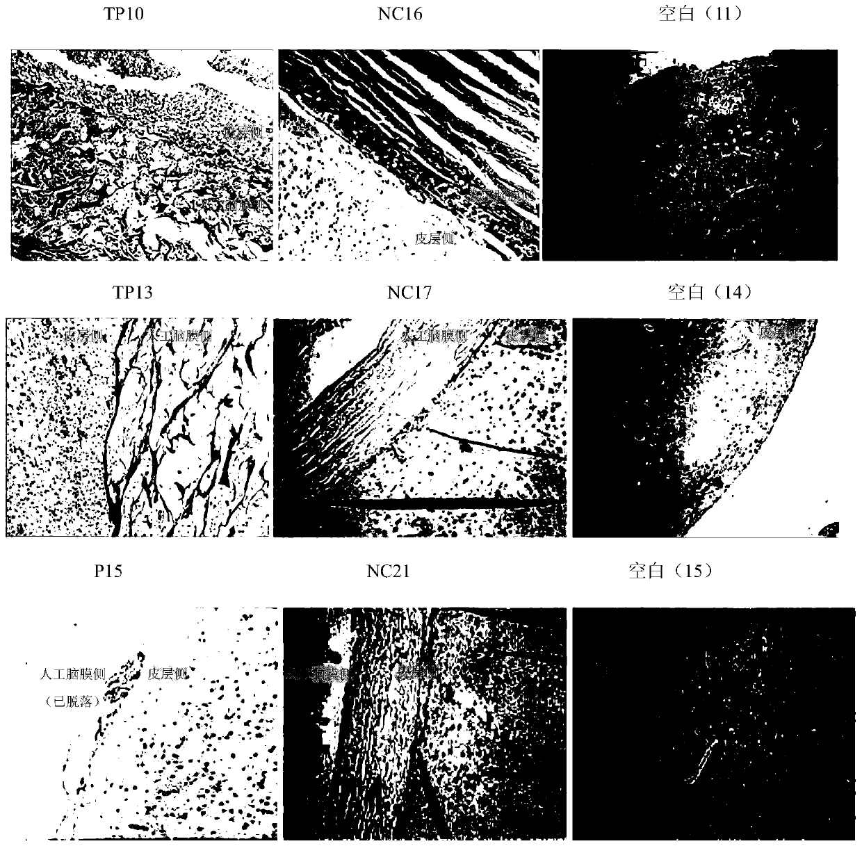 A kind of dura mater patch, preparation method and application in repairing of dura mater injury