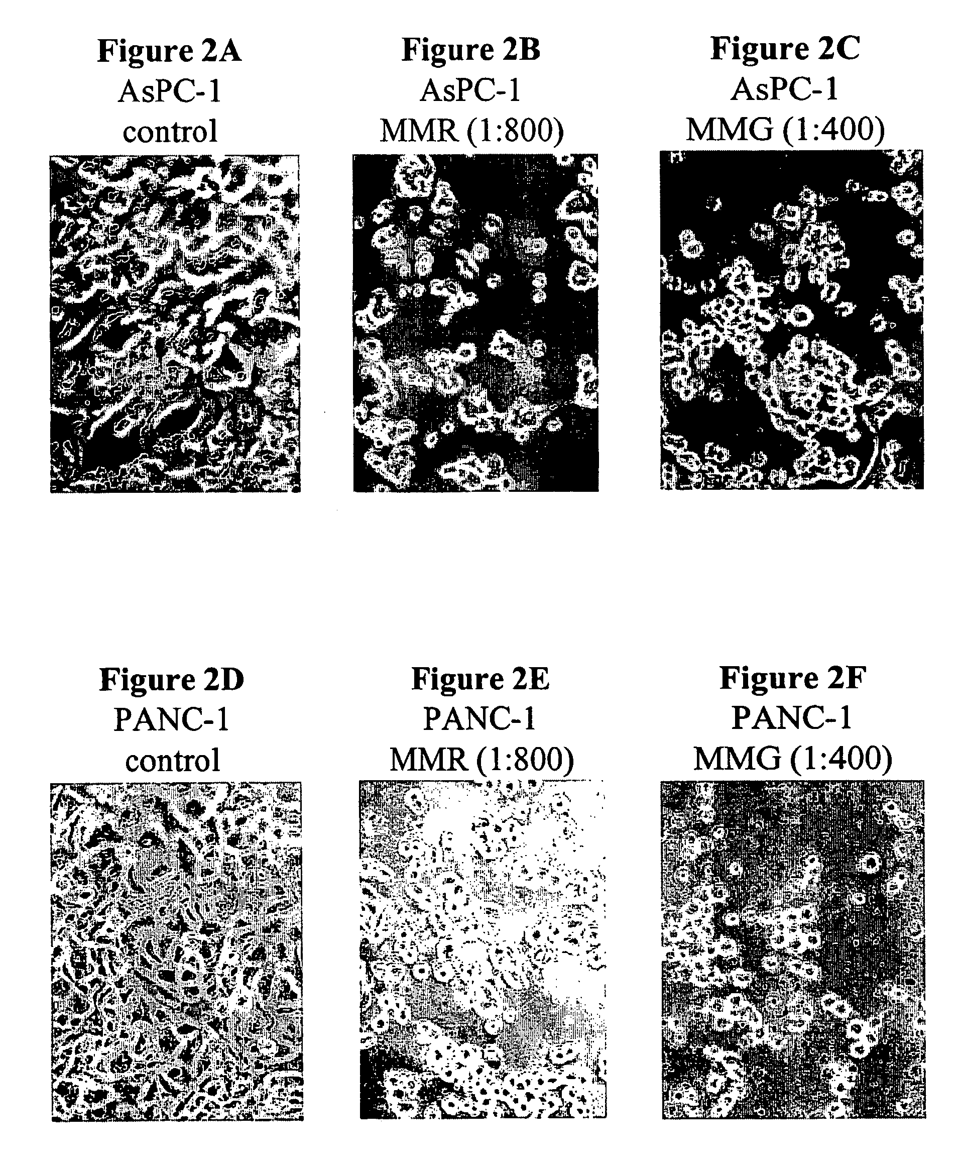 Compositions derived from Modiolus modiolus and methods for making and using same
