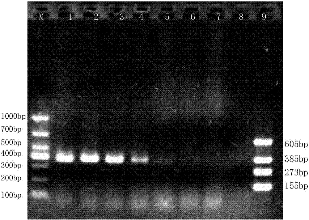 Multiple PCR detection primer groups for dairy cow mammitis pathogenic bacterium and application of multiple PCR detection primer groups