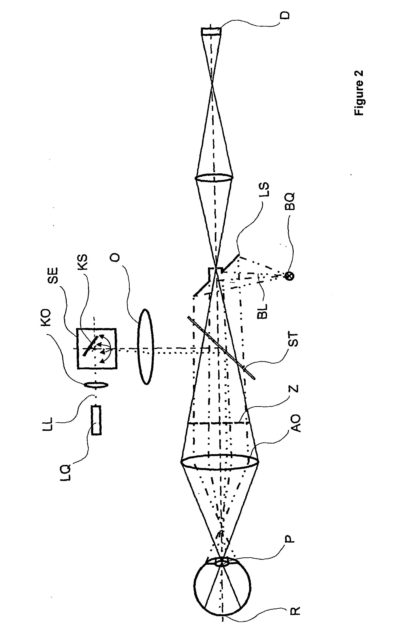 Ophthalmologic apparatus and method for the observation, examination, diagnosis, and/or treatment of an eye