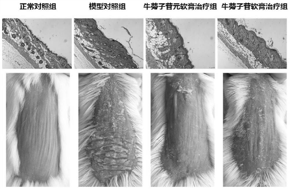 Application of arctiin and arctigenin in preparation of medicine for treating and/or preventing skin inflammations