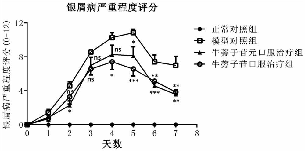 Application of arctiin and arctigenin in preparation of medicine for treating and/or preventing skin inflammations