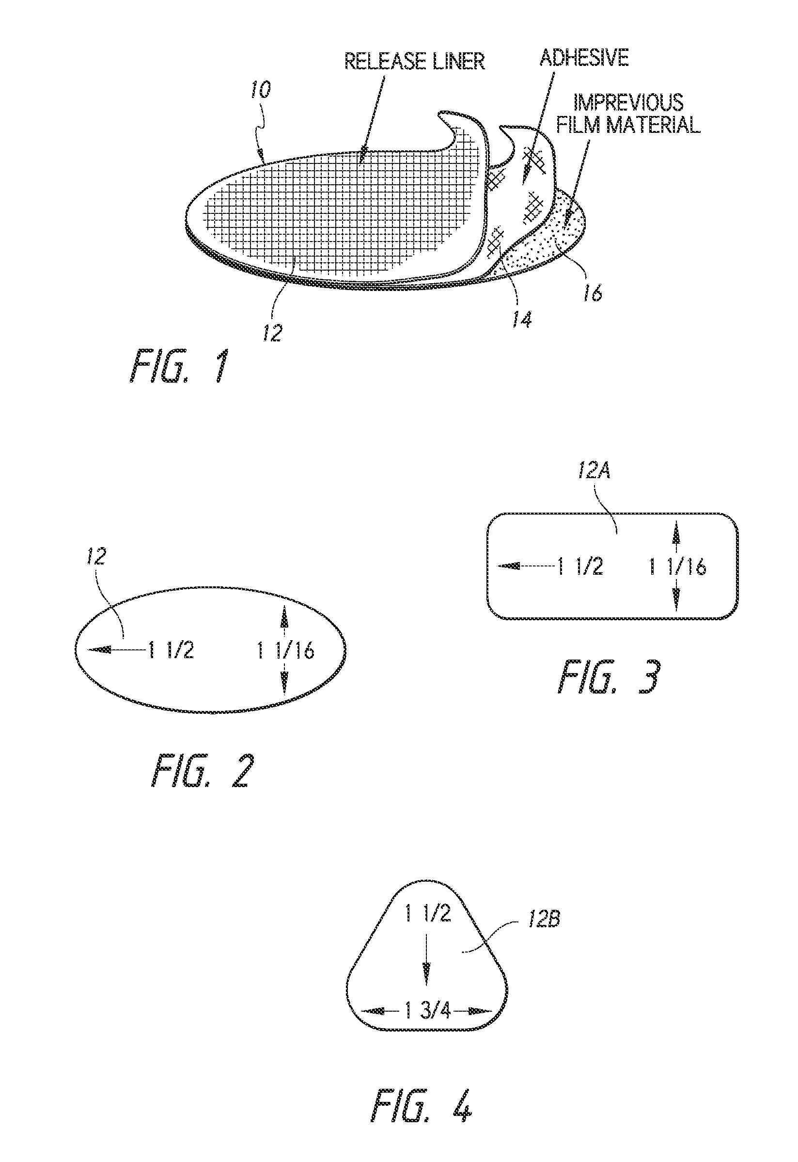 Systems and methods for treating female incontinence and pelvic nerve dysfunction