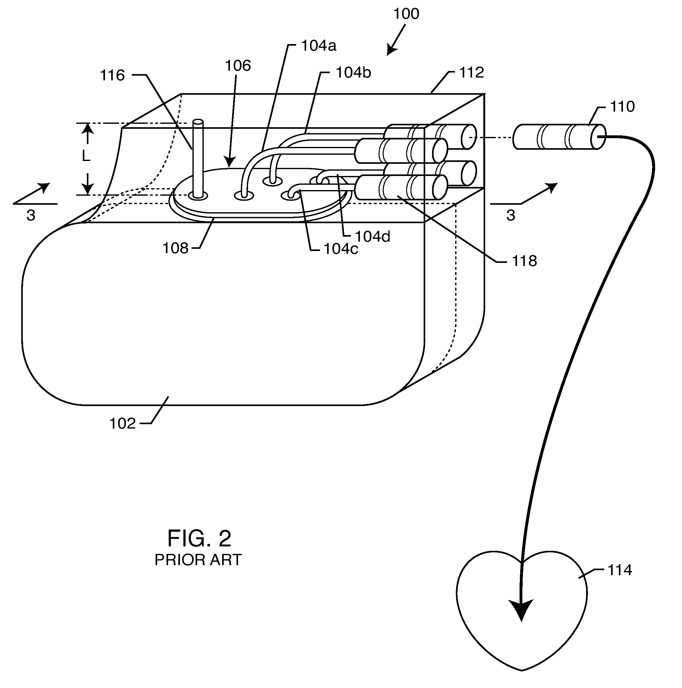 Band stop filter employing a capacitor and an inductor tank circuit to enhance MRI compatibility of active medical devices
