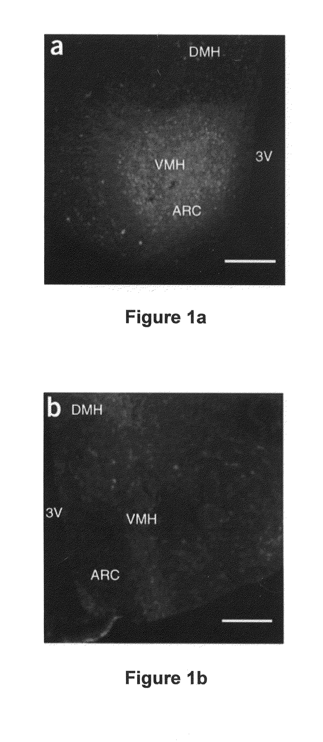 Treatment of Metabolic-Related Disorders Using Hypothalamic Gene Transfer of BDNF and Compositions Therefor